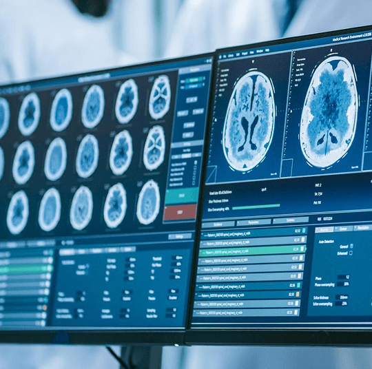 Brain-Tap-Technology